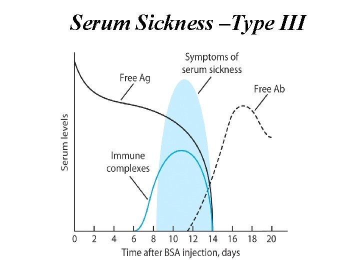 Serum Sickness –Type III Serum Sickness –Type III