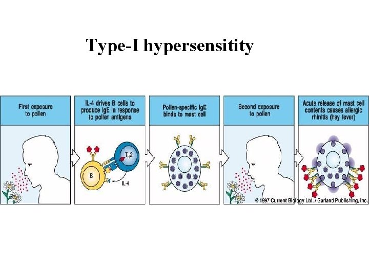 Type-I hypersensitity Type-I hypersensitity