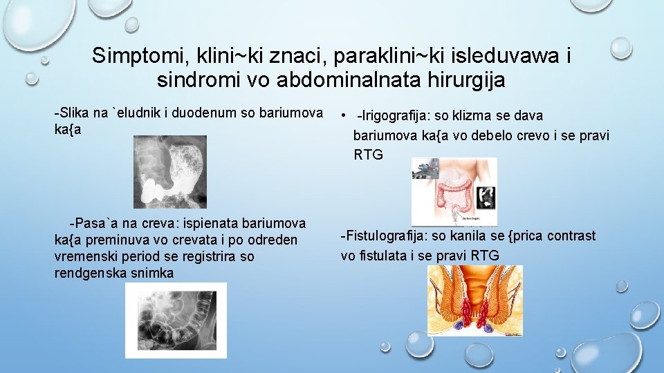 Simptomi, klini~ki znaci, paraklini~ki isleduvawa i sindromi vo abdominalnata hirurgija -Slika na `eludnik i