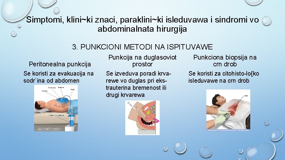 Simptomi, klini~ki znaci, paraklini~ki isleduvawa i sindromi vo abdominalnata hirurgija 3. PUNKCIONI METODI NA