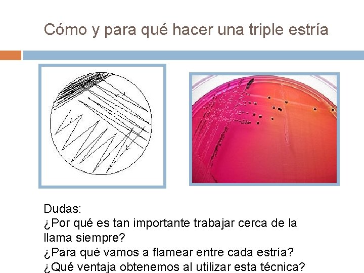 Cómo y para qué hacer una triple estría Dudas: ¿Por qué es tan importante