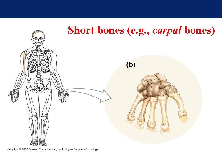 Short bones (e. g. , carpal bones) Short bones (e. g. , carpal bones)