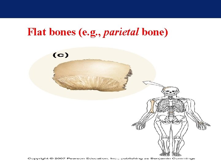 Flat bones (e. g. , parietal bone) Flat bones (e. g. , parietal bone)