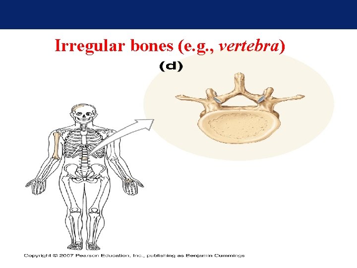 Irregular bones (e. g. , vertebra) Irregular bones (e. g. , vertebra)