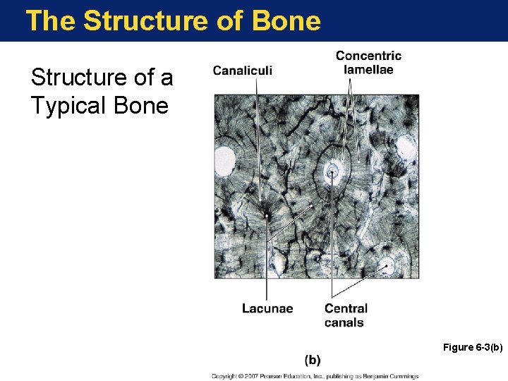 The Structure of Bone Structure of a Typical Bone Figure 6 -3(b) The Structure of Bone Structure of a Typical Bone Figure 6 -3(b)