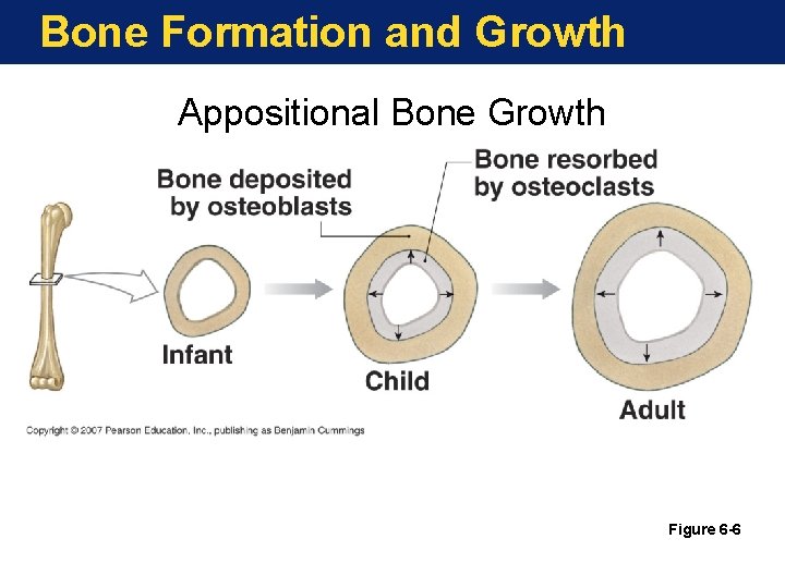 Bone Formation and Growth Appositional Bone Growth Figure 6 -6 Bone Formation and Growth Appositional Bone Growth Figure 6 -6