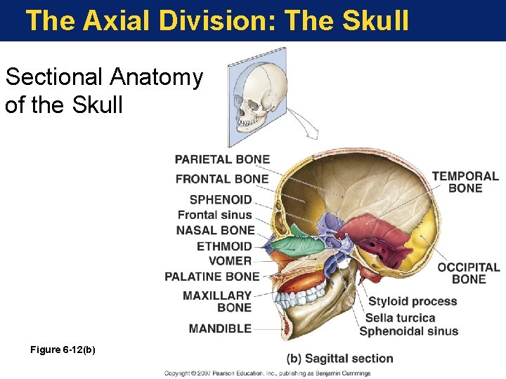 The Axial Division: The Skull Sectional Anatomy of the Skull Figure 6 -12(b) The Axial Division: The Skull Sectional Anatomy of the Skull Figure 6 -12(b)
