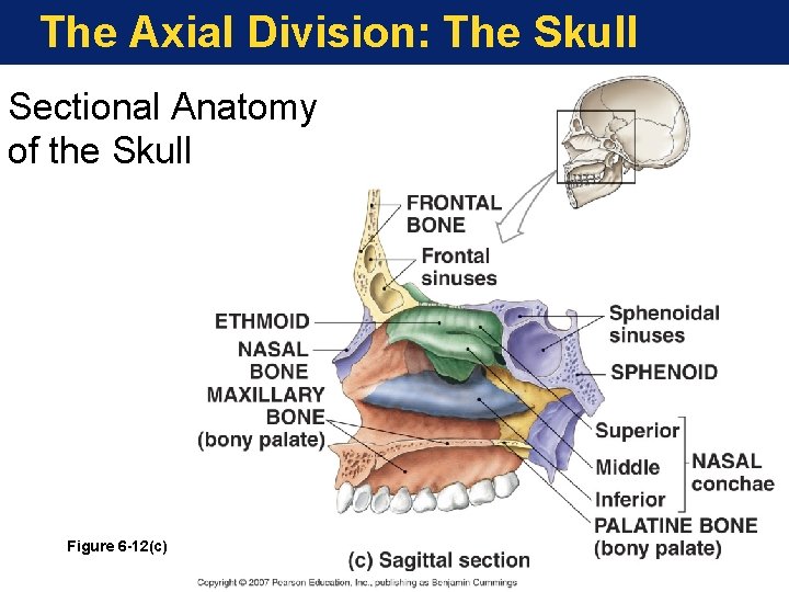 The Axial Division: The Skull Sectional Anatomy of the Skull Figure 6 -12(c) The Axial Division: The Skull Sectional Anatomy of the Skull Figure 6 -12(c)