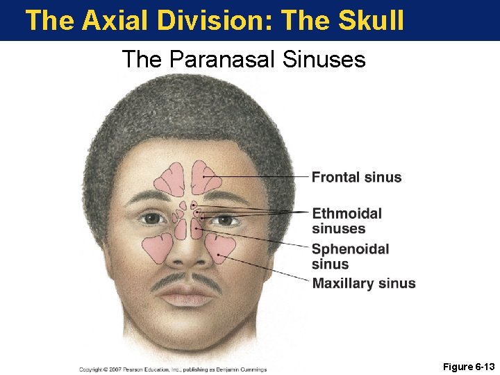 The Axial Division: The Skull The Paranasal Sinuses Figure 6 -13 The Axial Division: The Skull The Paranasal Sinuses Figure 6 -13