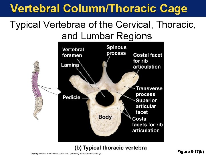 Vertebral Column/Thoracic Cage Typical Vertebrae of the Cervical, Thoracic, and Lumbar Regions Figure 6 Vertebral Column/Thoracic Cage Typical Vertebrae of the Cervical, Thoracic, and Lumbar Regions Figure 6
