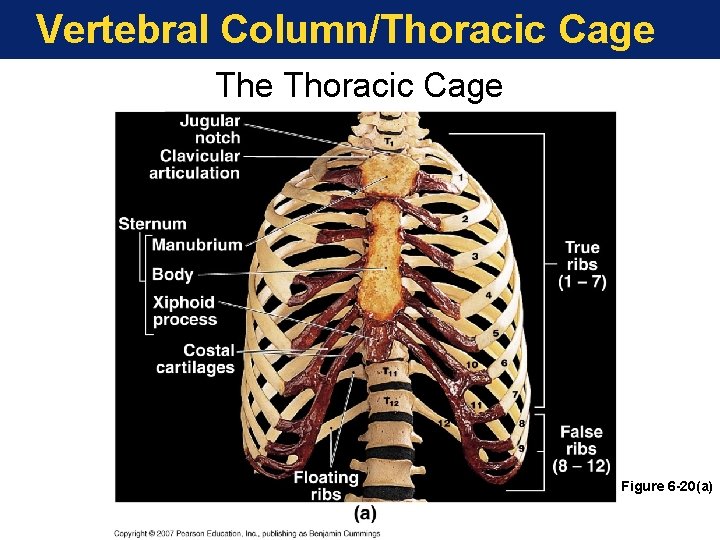 Vertebral Column/Thoracic Cage Figure 6 -20(a) Vertebral Column/Thoracic Cage Figure 6 -20(a)