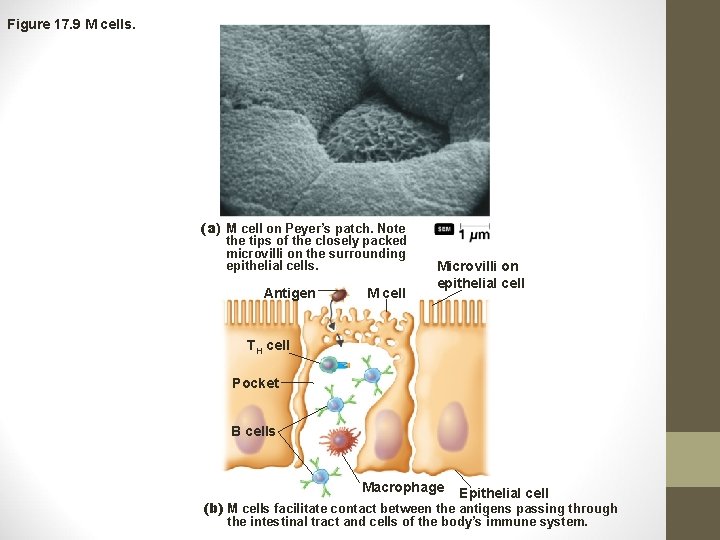 Figure 17. 9 M cells. (a) M cell on Peyer’s patch. Note the tips