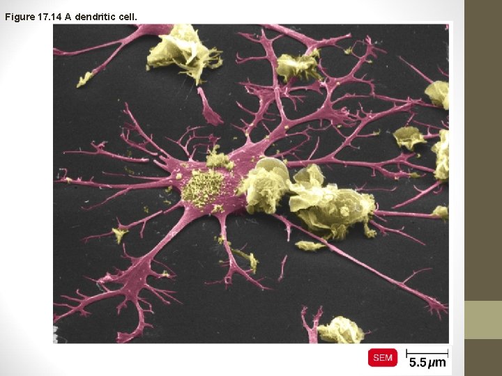 Figure 17. 14 A dendritic cell. 