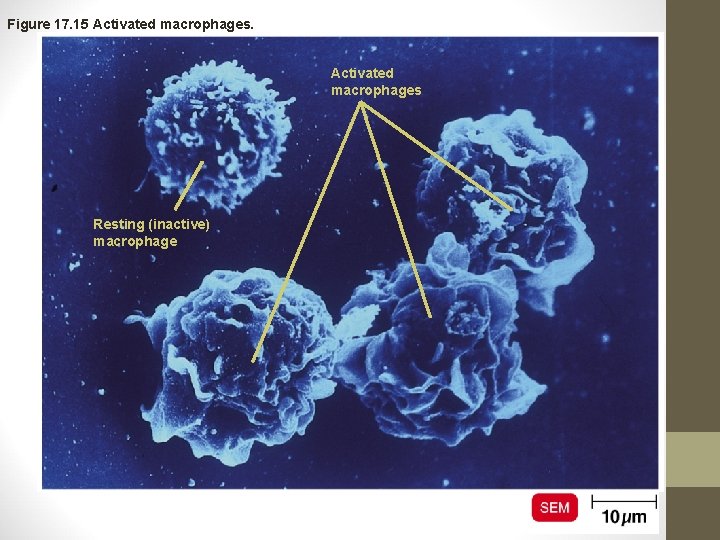 Figure 17. 15 Activated macrophages Resting (inactive) macrophage 