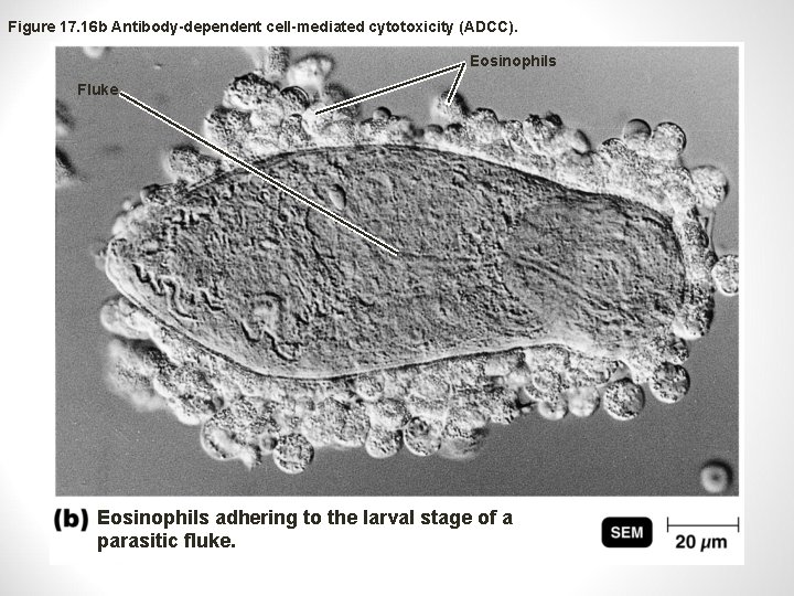 Figure 17. 16 b Antibody-dependent cell-mediated cytotoxicity (ADCC). Eosinophils Fluke Eosinophils adhering to the