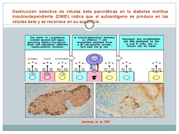 Destrucción selectiva de células beta pancráticas en la diabetes mellitus insulinodependiente (DMID) indica que