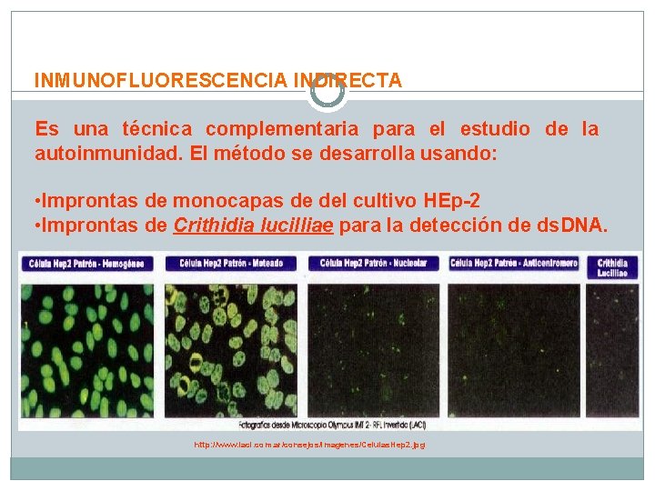 INMUNOFLUORESCENCIA INDIRECTA Es una técnica complementaria para el estudio de la autoinmunidad. El método