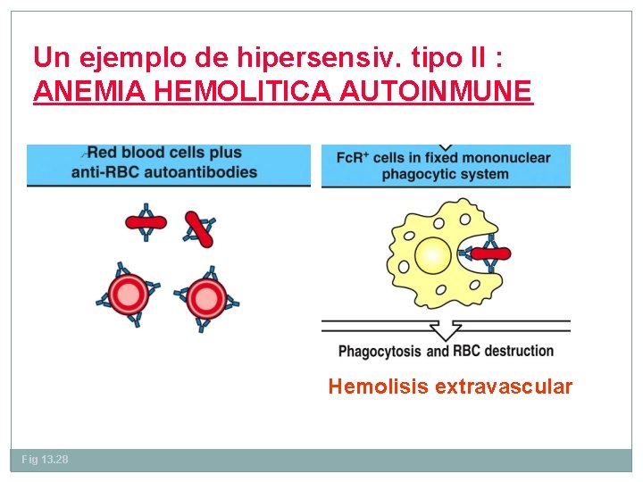 Un ejemplo de hipersensiv. tipo II : ANEMIA HEMOLITICA AUTOINMUNE Hemolisis extravascular Fig 13.