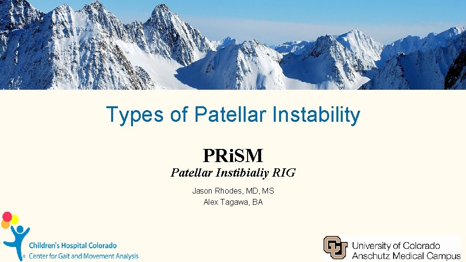 Types of Patellar Instability PRi. SM Patellar Instibialiy RIG Jason Rhodes, MD, MS Alex