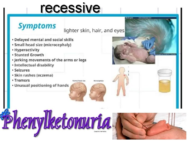 recessive 