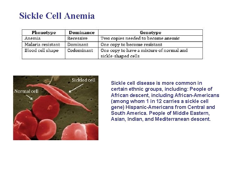 Sickle Cell Anemia Sickle cell disease is more common in certain ethnic groups, including: