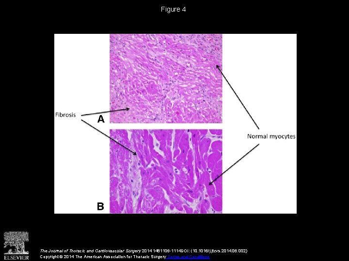 Figure 4 The Journal of Thoracic and Cardiovascular Surgery 2014 1481106 -1114 DOI: (10.