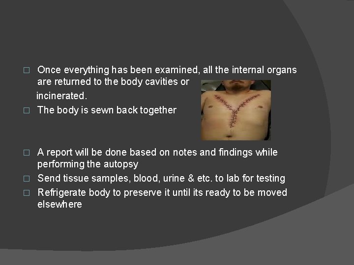 Once everything has been examined, all the internal organs are returned to the body