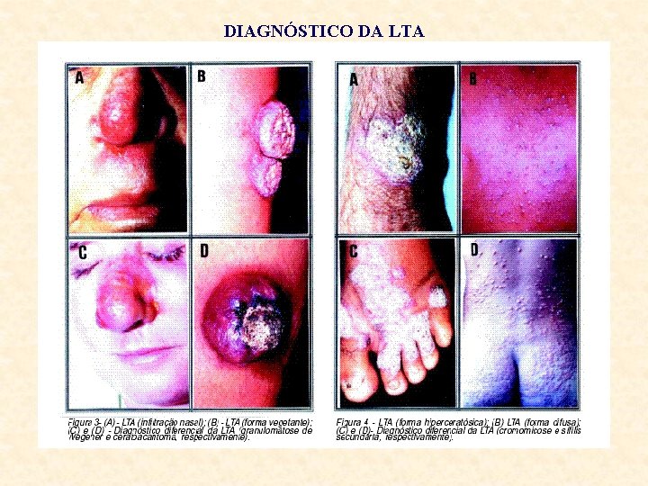 DIAGNÓSTICO DA LTA 
