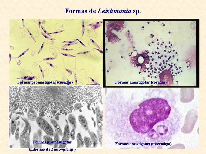 Formas de Leishmania sp. Formas promastigotas (coradas) Formas promastigotas (intestino da Lutzomyia sp. )