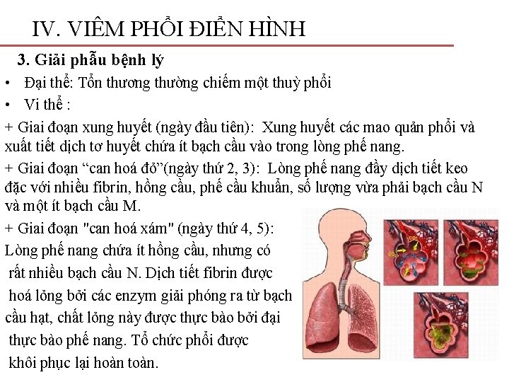 IV. VIÊM PHỔI ĐIỂN HÌNH 3. Giải phẫu bệnh lý • Đại thể: Tổn