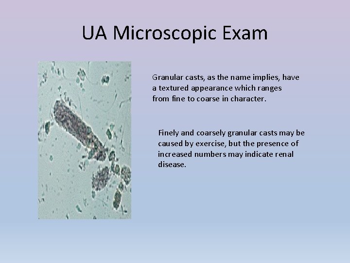 UA Microscopic Exam Granular casts, as the name implies, have a textured appearance which