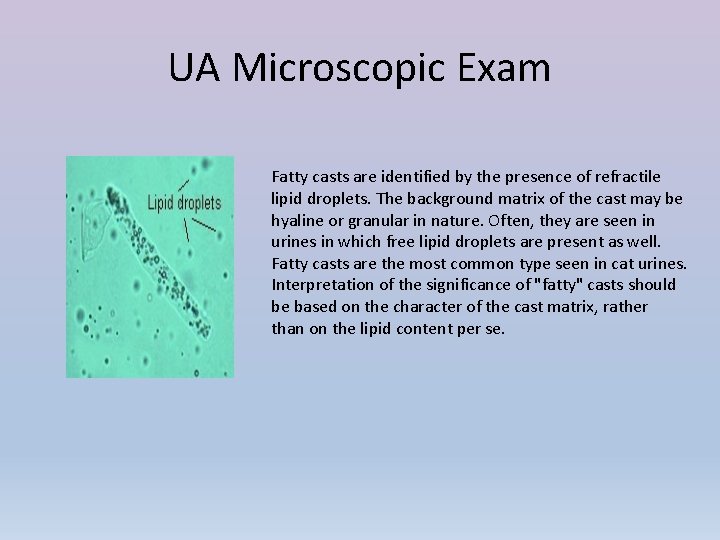 UA Microscopic Exam Fatty casts are identified by the presence of refractile lipid droplets.