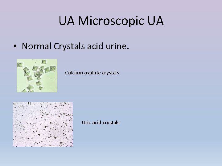 UA Microscopic UA • Normal Crystals acid urine. Calcium oxalate crystals Uric acid crystals
