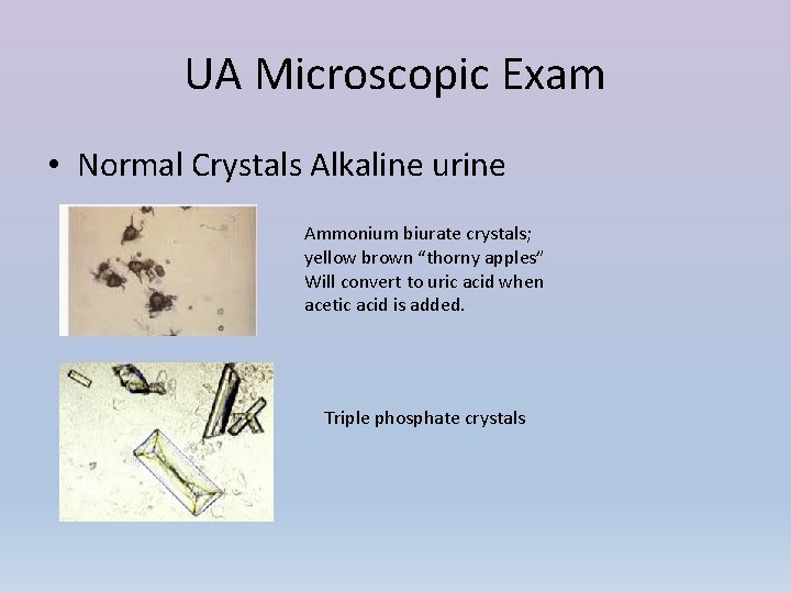 UA Microscopic Exam • Normal Crystals Alkaline urine Ammonium biurate crystals; yellow brown “thorny