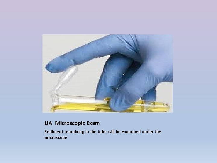 UA Microscopic Exam Sediment remaining in the tube will be examined under the microscope