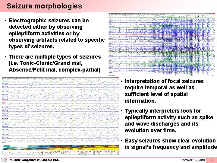 Seizure morphologies • Electrographic seizures can be detected either by observing epileptiform activities or