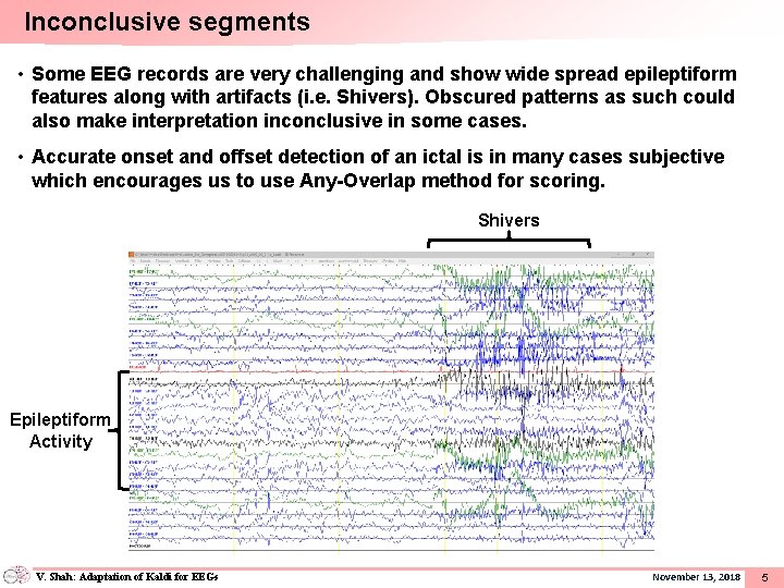 Inconclusive segments • Some EEG records are very challenging and show wide spread epileptiform