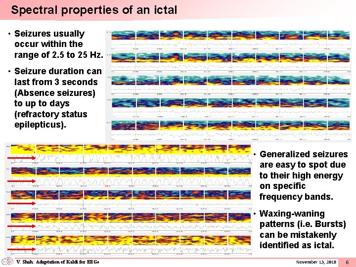 Spectral properties of an ictal • Seizures usually occur within the range of 2.