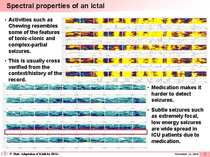 Spectral properties of an ictal • Activities such as Chewing resembles some of the