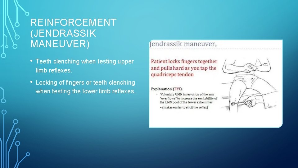 REINFORCEMENT (JENDRASSIK MANEUVER) • Teeth clenching when testing upper limb reflexes. • Locking of