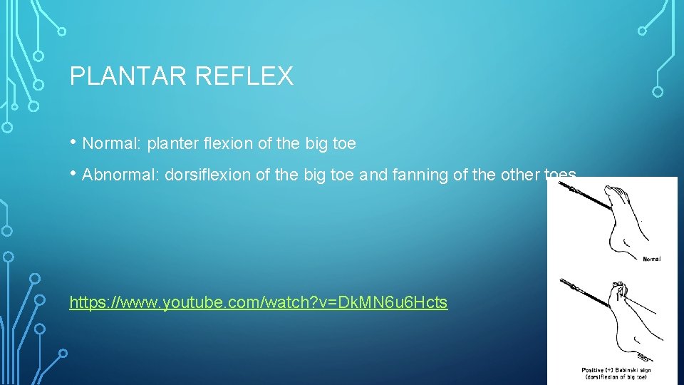 PLANTAR REFLEX • Normal: planter flexion of the big toe • Abnormal: dorsiflexion of