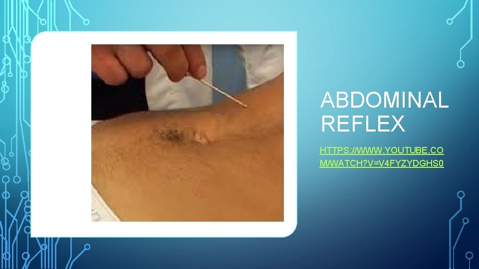 ABDOMINAL REFLEX HTTPS: //WWW. YOUTUBE. CO M/WATCH? V=V 4 FYZYDGHS 0 