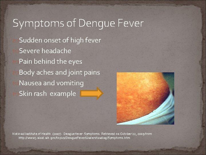 Symptoms of Dengue Fever Sudden onset of high fever Severe headache Pain behind the