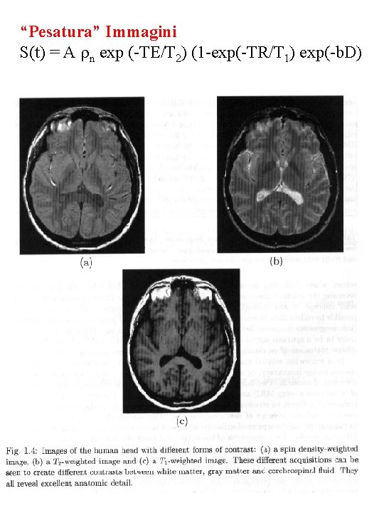 “Pesatura” Immagini S(t) = A n exp (-TE/T 2) (1 -exp(-TR/T 1) exp(-b. D)