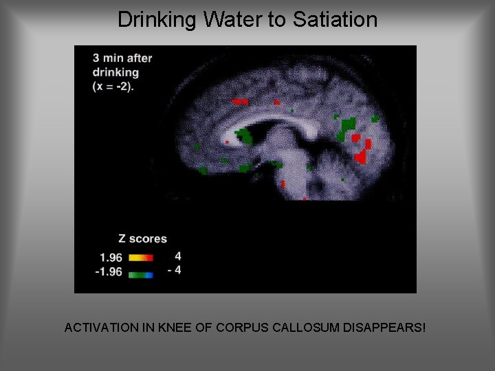 Drinking Water to Satiation ACTIVATION IN KNEE OF CORPUS CALLOSUM DISAPPEARS! 