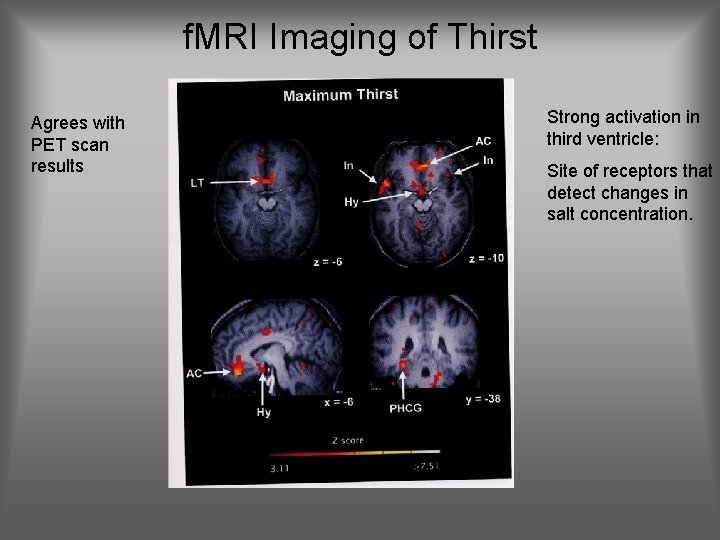 f. MRI Imaging of Thirst Agrees with PET scan results Strong activation in third