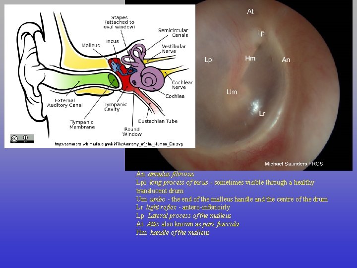 http: //commons. wikimedia. org/wiki/File: Anatomy_of_the_Human_Ear. svg An annulus fibrosus Lpi long process of incus