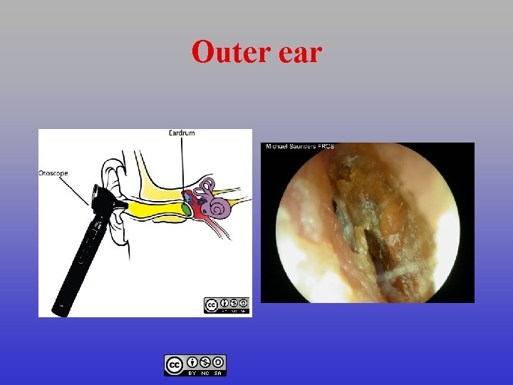 Outer ear 