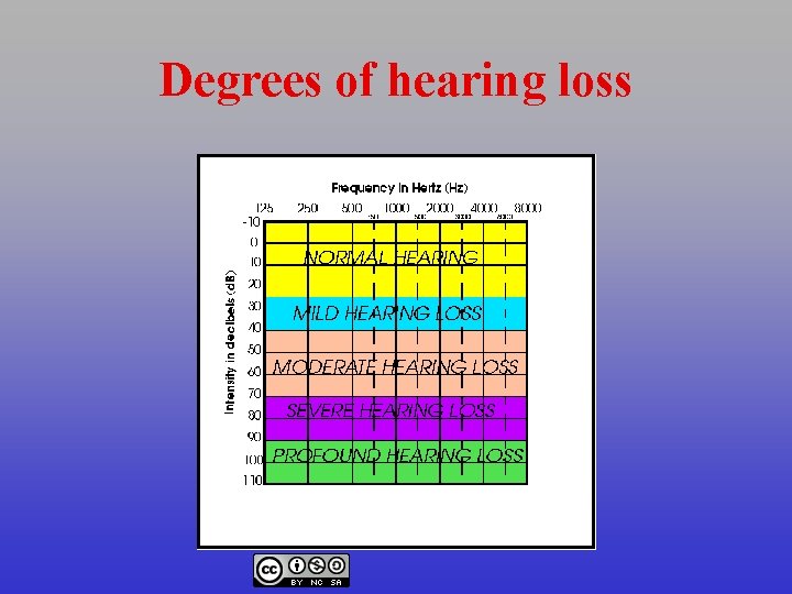 Degrees of hearing loss 