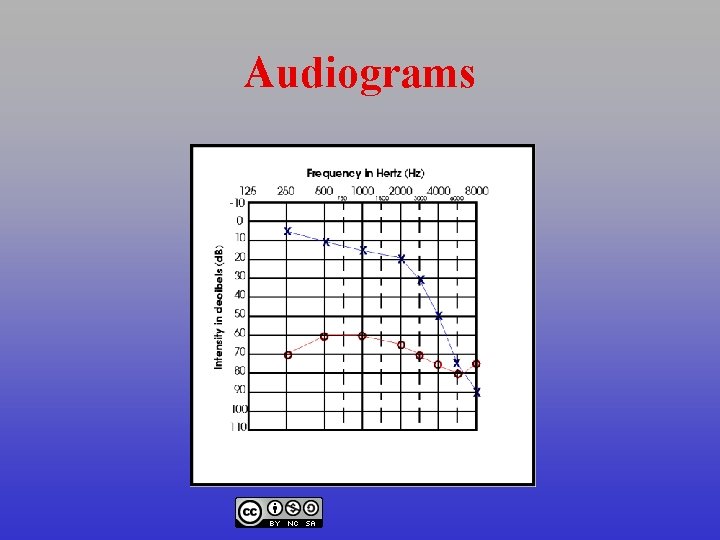 Audiograms 